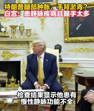 种病在70岁以上人群中尤为普遍AG真人中